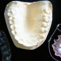 Unveiling the Role of X-Rays in Forensic Odontology