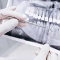 What is the Difference Between Dentists and Odontologists?