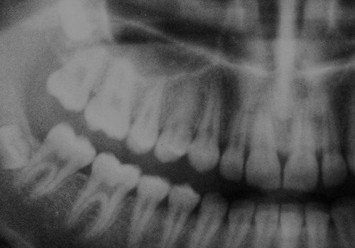 Unveiling the Different Types of Tests Used to Analyze Dental Evidence in Court